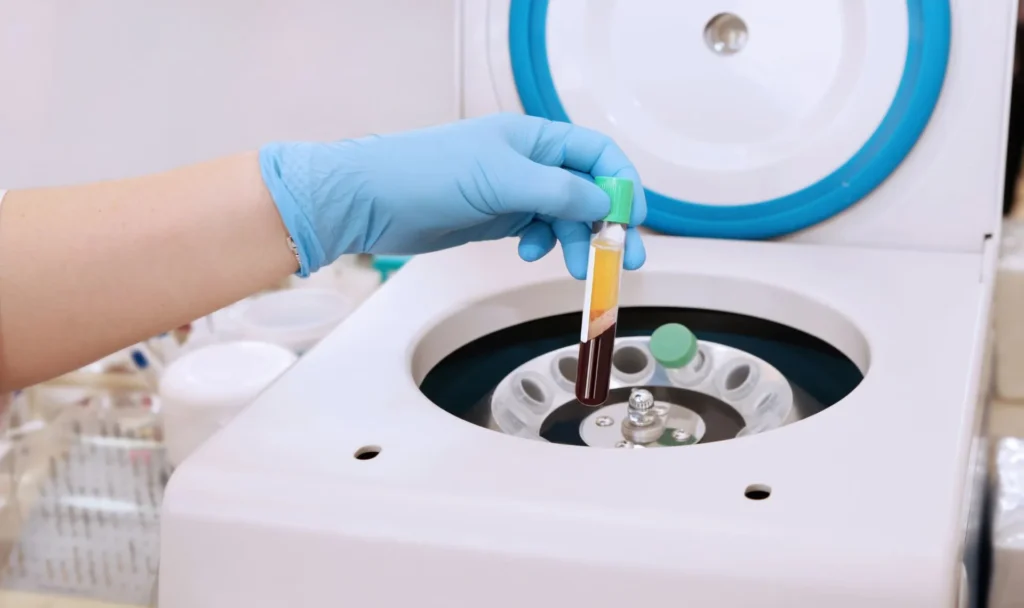 venopunciones dentista centrifugadora